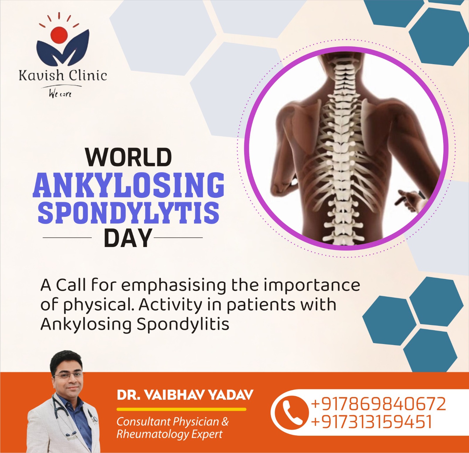 World Ankylosing Spondylitis Day